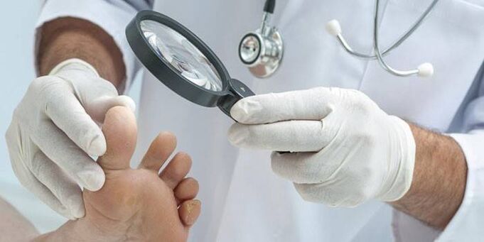 πώς να αντιμετωπίσετε τους μύκητες